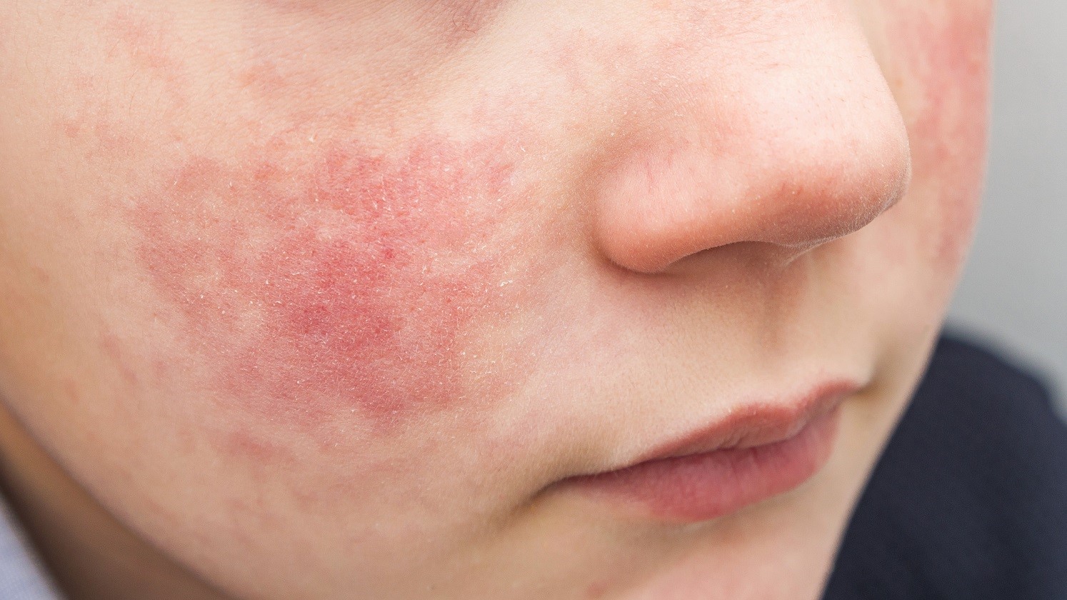 别让精油变成隐形炸弹！科学用油，这一步是关键